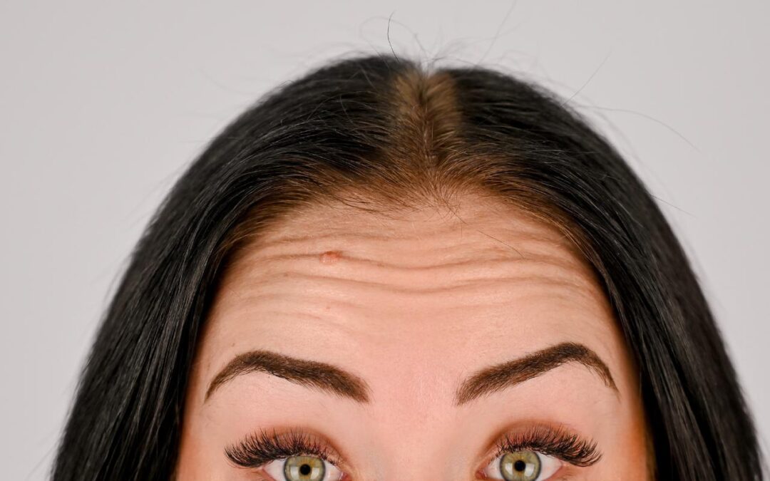 Botox vs. Fillers: What’s the Difference and Which Is Right for You?